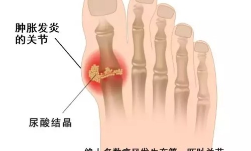 健立多补钙效果网 | 建力多钙片的功效,健力多钙片多少钱一瓶